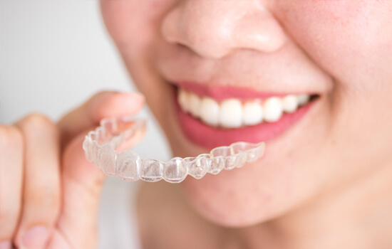 clear aligners with teeth whitening