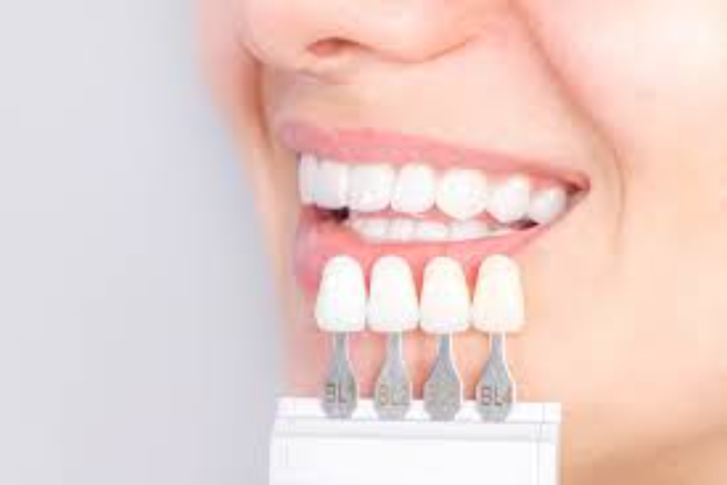 porcelain vs zirconia crowns