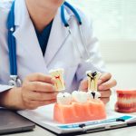 How to Care for Your Tooth Gem and Maintain Oral Health