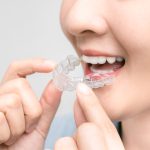 what are suresmile clear aligners and are they good for teens